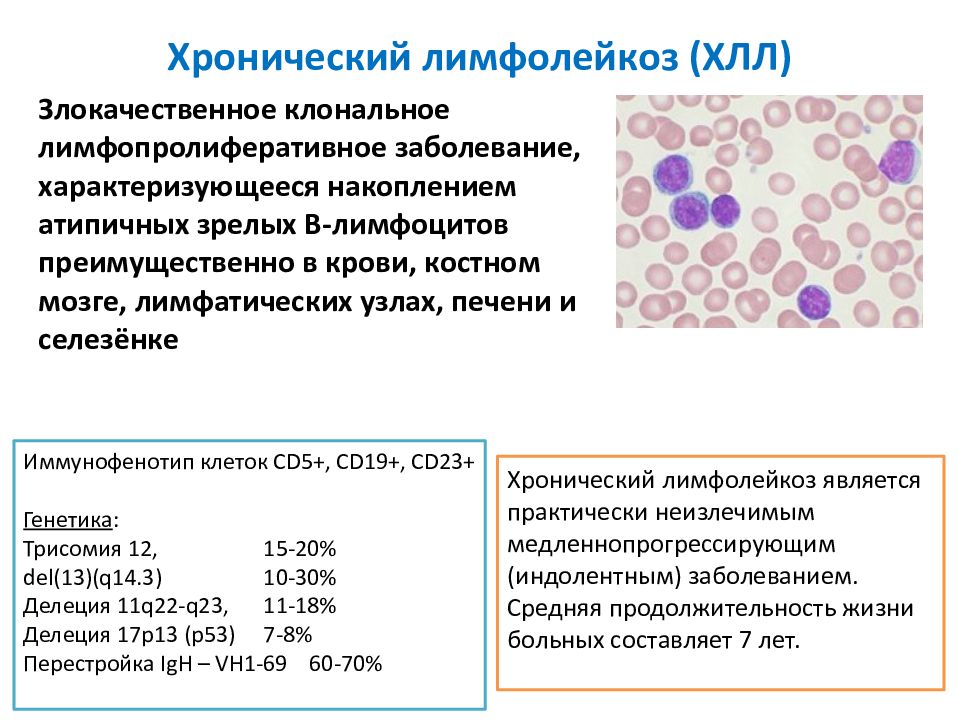 Картина крови при хроническом лимфолейкозе