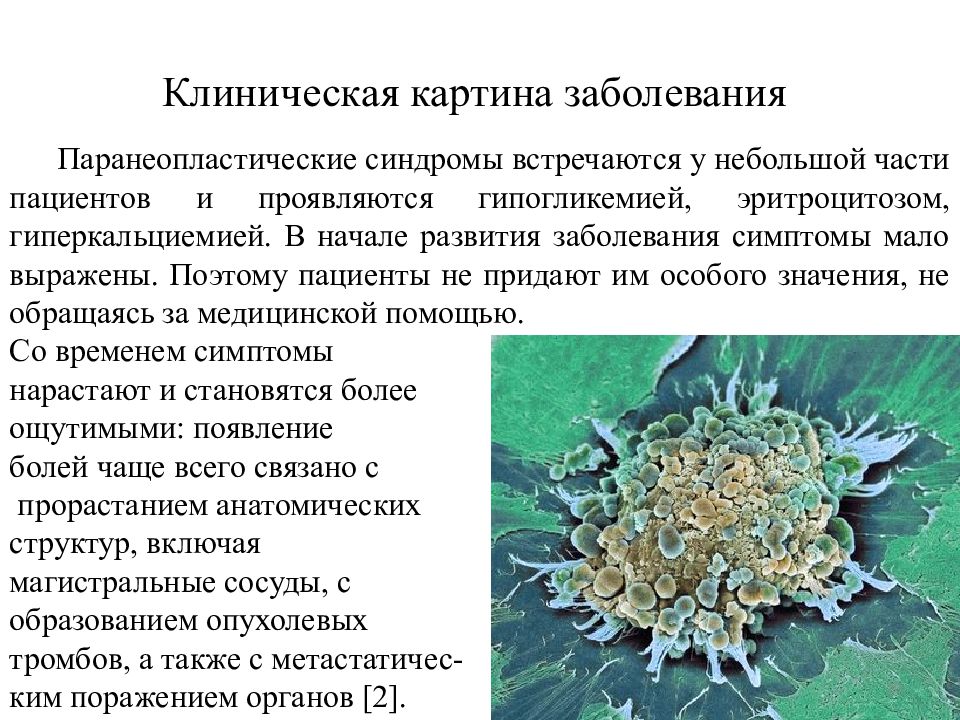 Гепатоцеллюлярный рак презентация