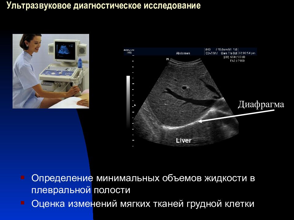 Узи плевральной. УЗИ плевральных полостей методика. УЗИ плевральных полостей плеврит. Ультразвуковое исследование при плеврите. УЗИ плевральных полостей методика проведения.