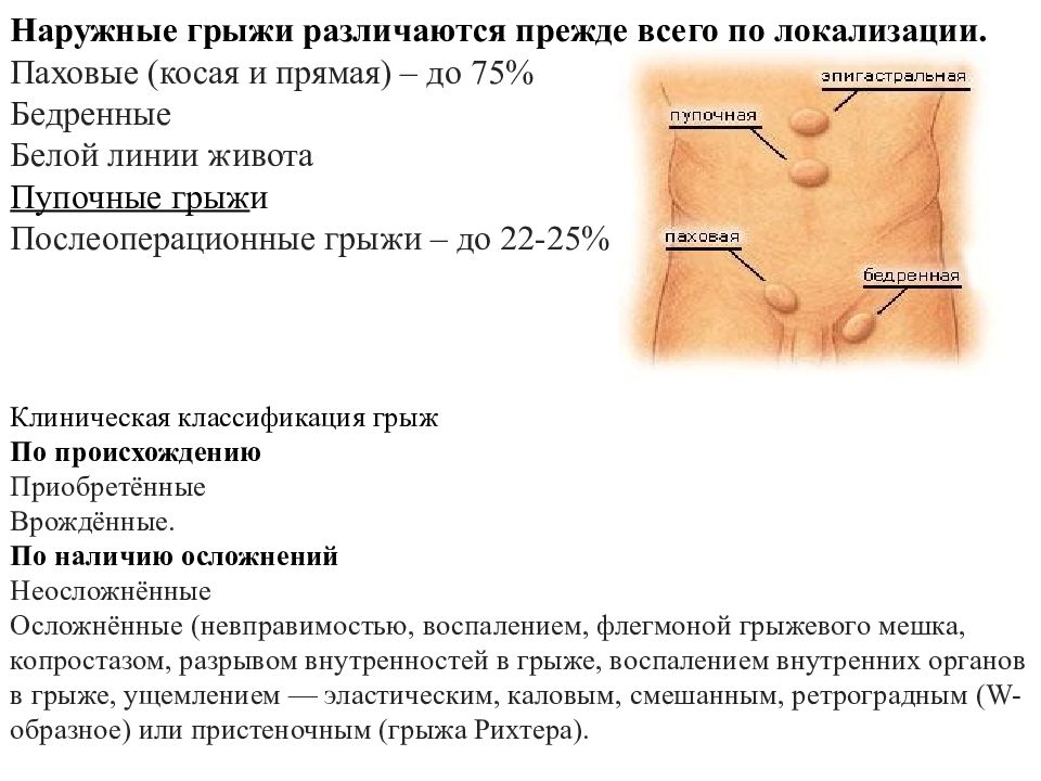 Грыжи живота госпитальная хирургия презентация