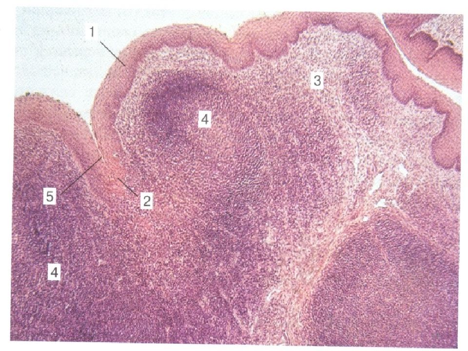 Небная миндалина гистология рисунок