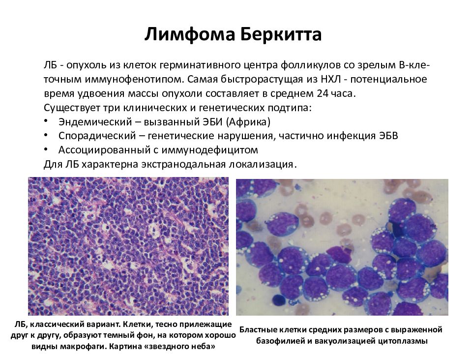 Болезнь ходжкина картина крови