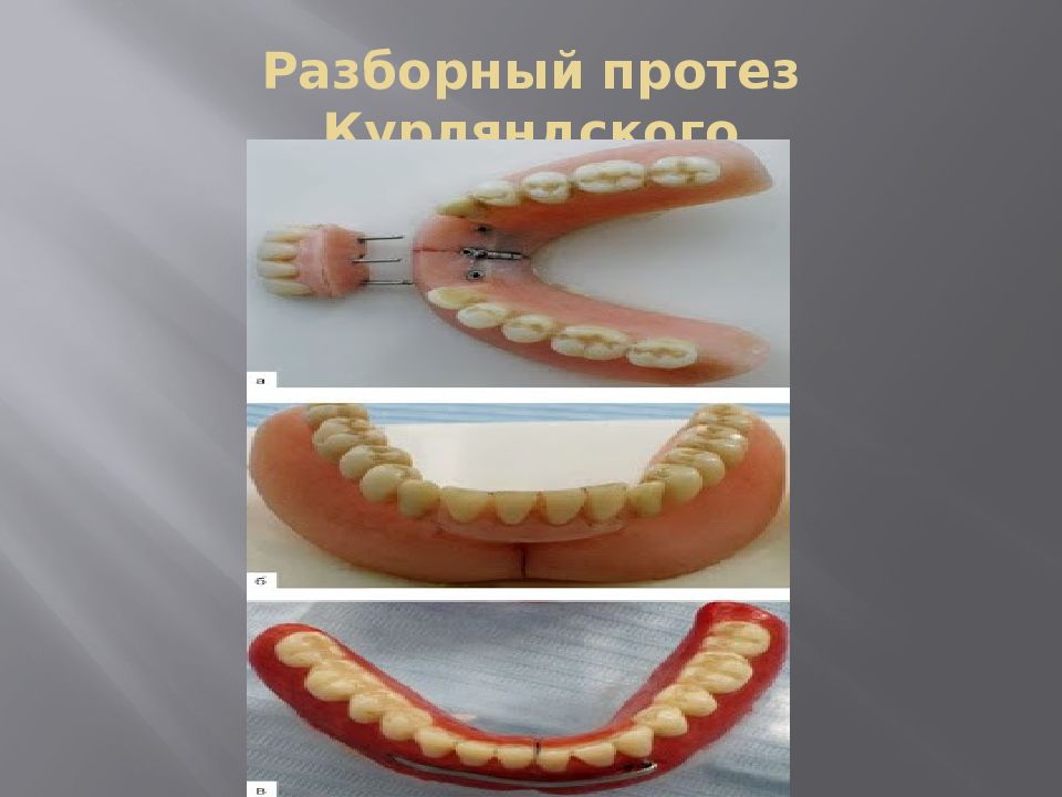 Шарнир курляндского