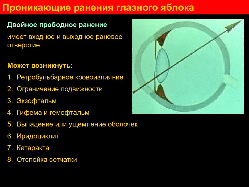 Пр никнуть. Прободное ранение склеры. Проникающая рана глазного яблока. Непроникающие ранения глазного яблока.