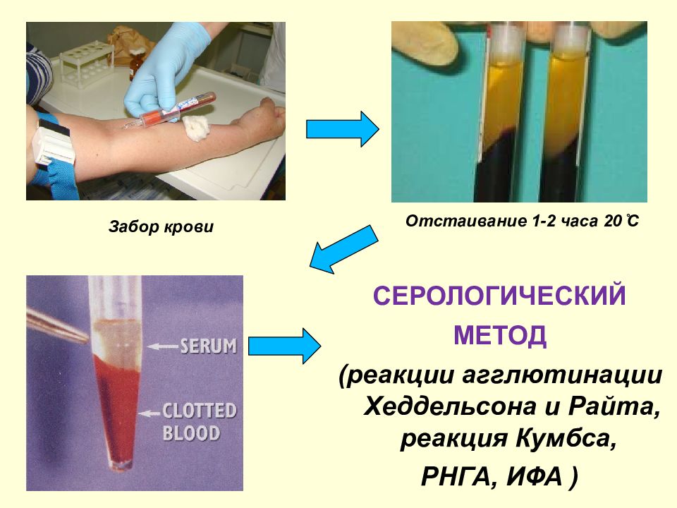 Серологические реакции рисунки