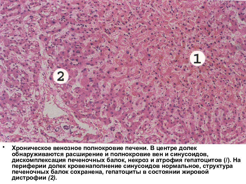 Мускатная печень рисунок