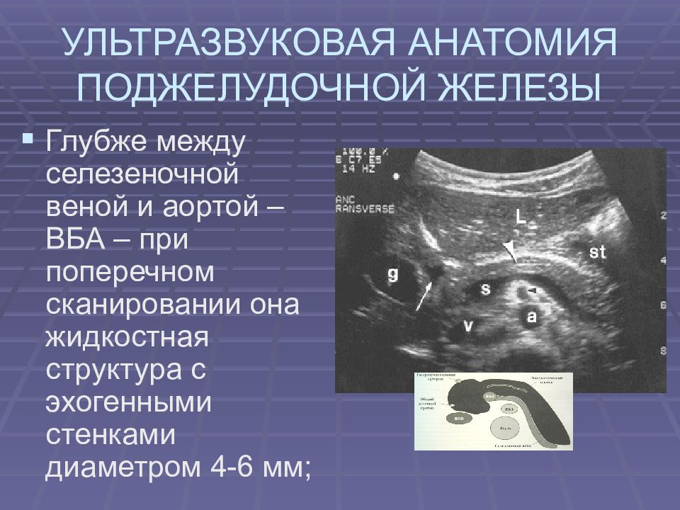 Образование на узи поджелудочной. УЗИ поджелудочной верхняя брыжеечная Вена селезеночная. При ультразвуковом исследовании жидкостные структуры имеют вид. Исследования поджелудочной СССР.