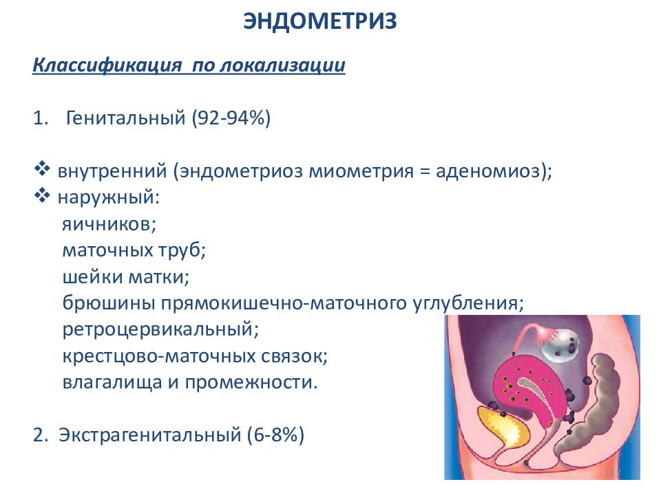 Факторы риска эндометриоза