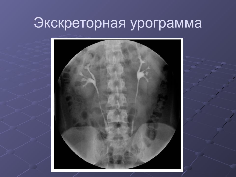 Лучевая диагностика почек презентация