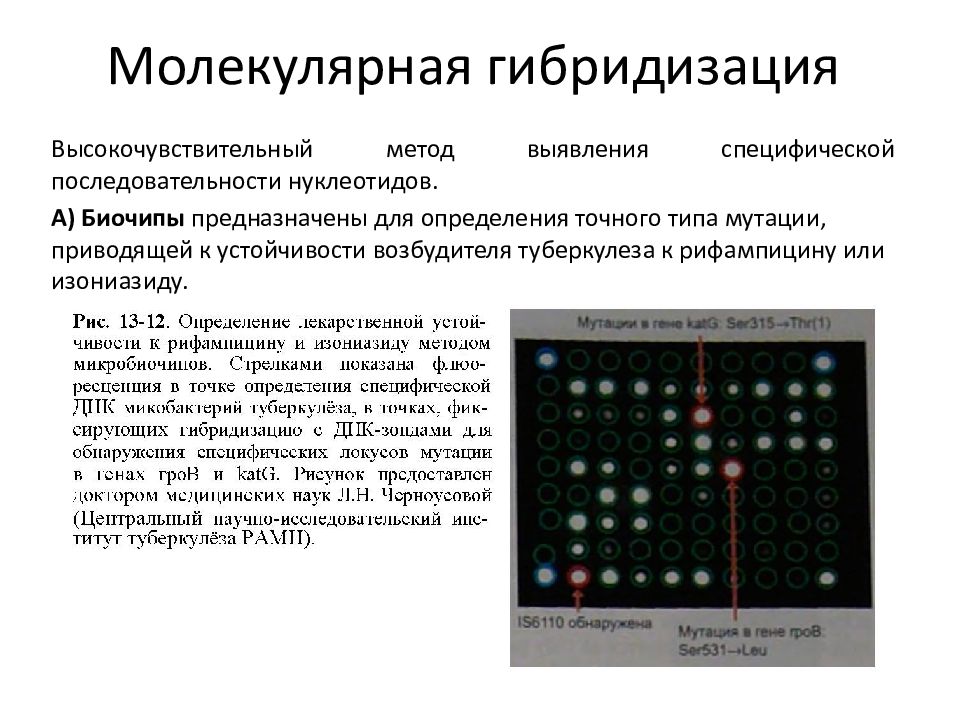 Микробиологическая диагностика туберкулеза