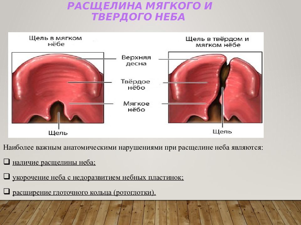 Твердое небо