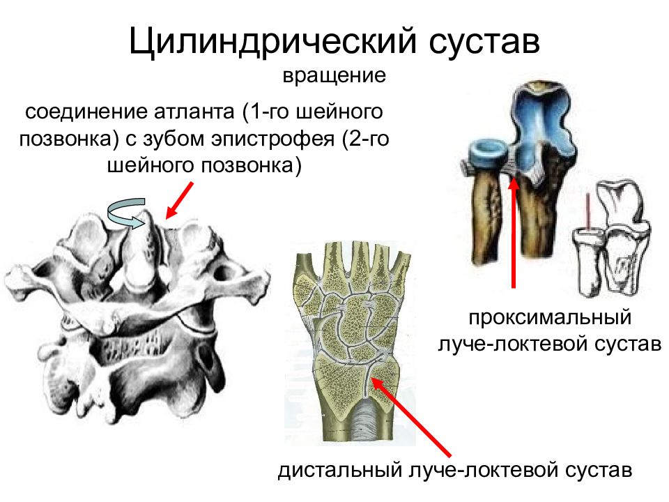 Какие есть суставы. Цилиндрический сустав строение. Блоковидные и цилиндрические суставы. Одноосный сустав (блоковидный и цилиндрический). Одноосные суставы анатомия.