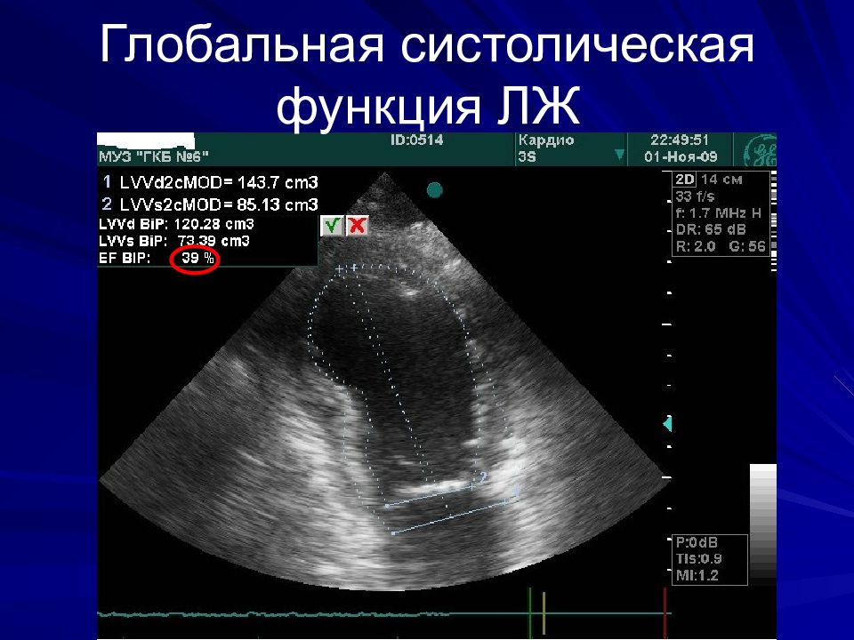 Эхокардиография сердца презентация