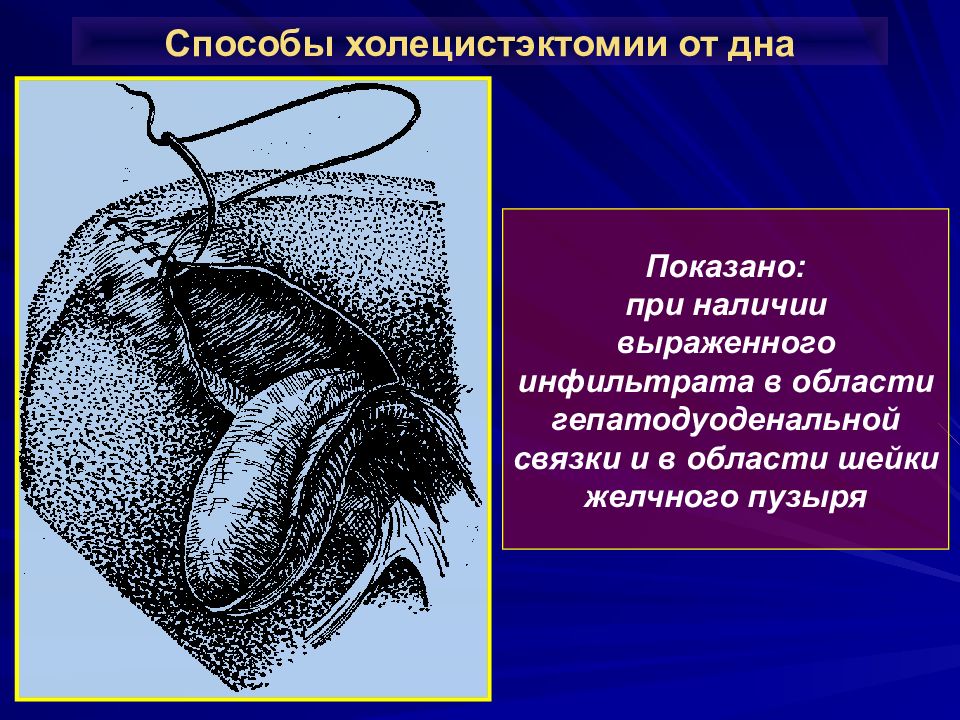 Механическая желтуха презентация по хирургии