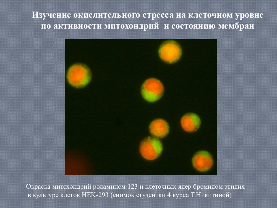 Основы микроскопии. Окраска ядер клеток. Флуоресцентная микроскопия митохондрий. Родамин 123 и митохондрии. Окраска родамином.