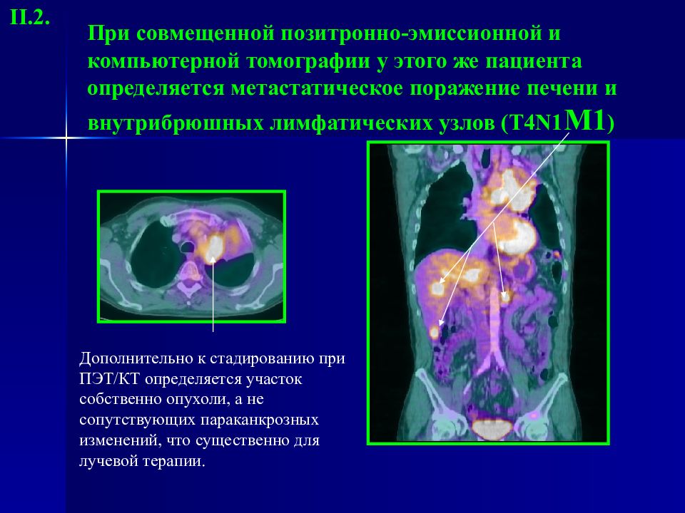 Лучевая диагностика заболеваний головы и шеи презентация