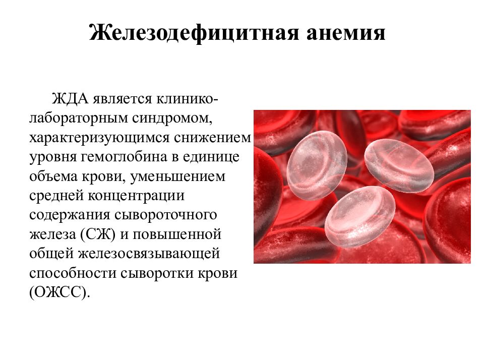 Понятие анемии. Железодефицитная анемия гемоглобин. Анемия презентация.