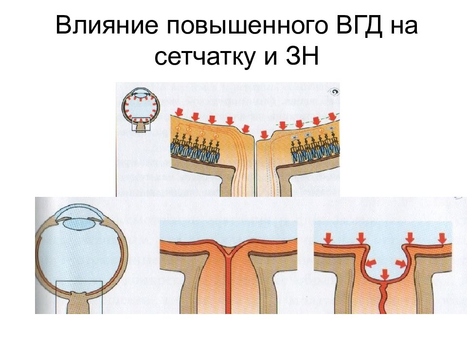 Влияние повышенного