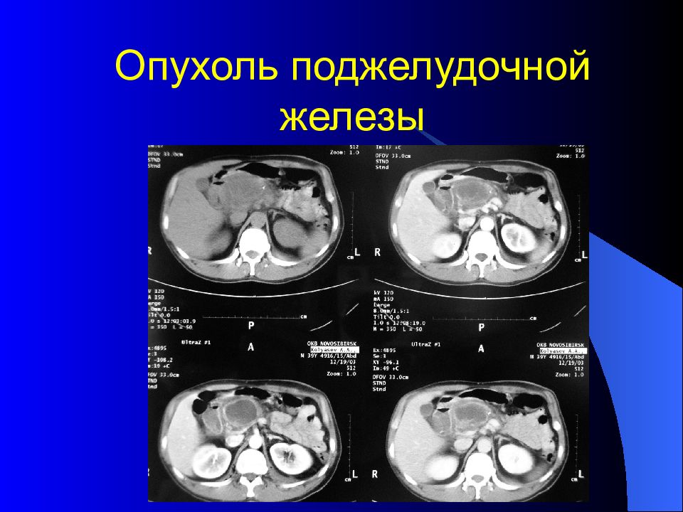 Лучевая диагностика брюшной полости презентация