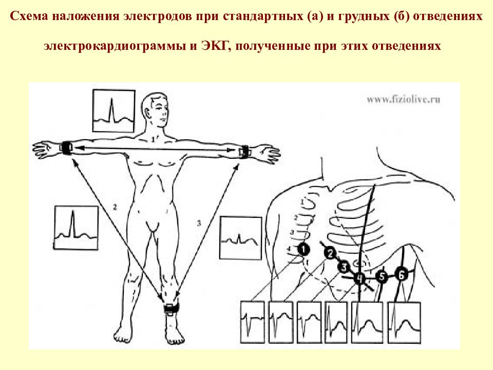 Кардиоджет инструкция по применению схема наложения электродов