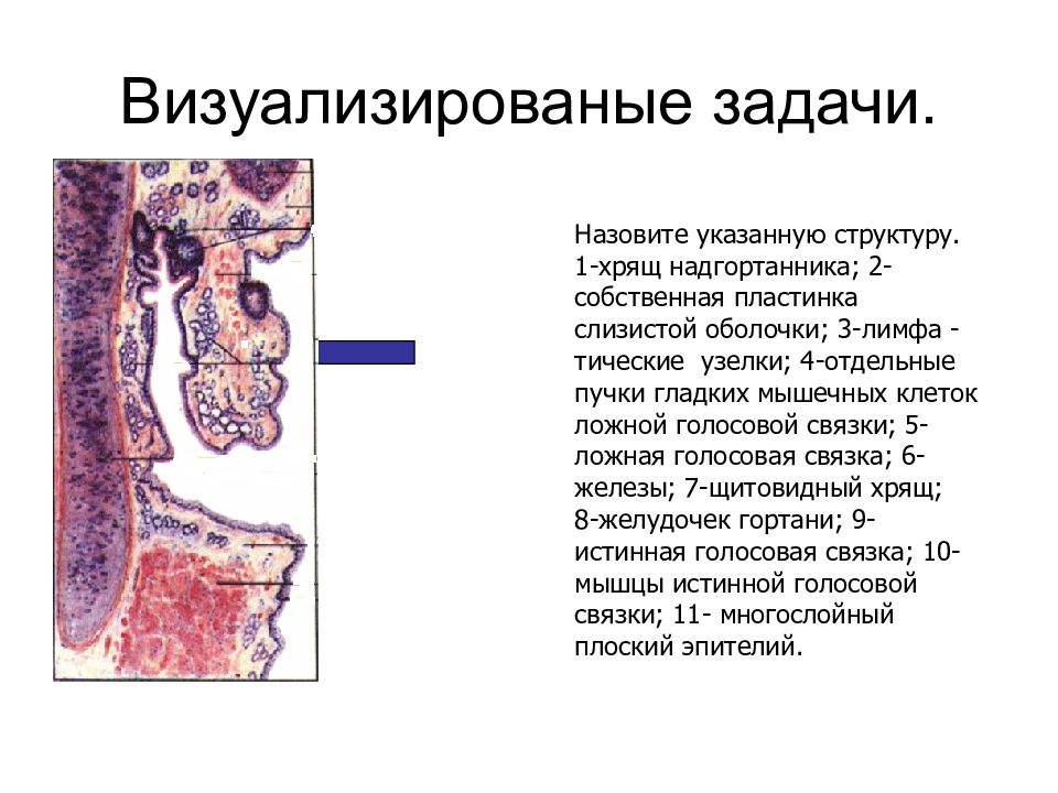 Эпителий надгортанника