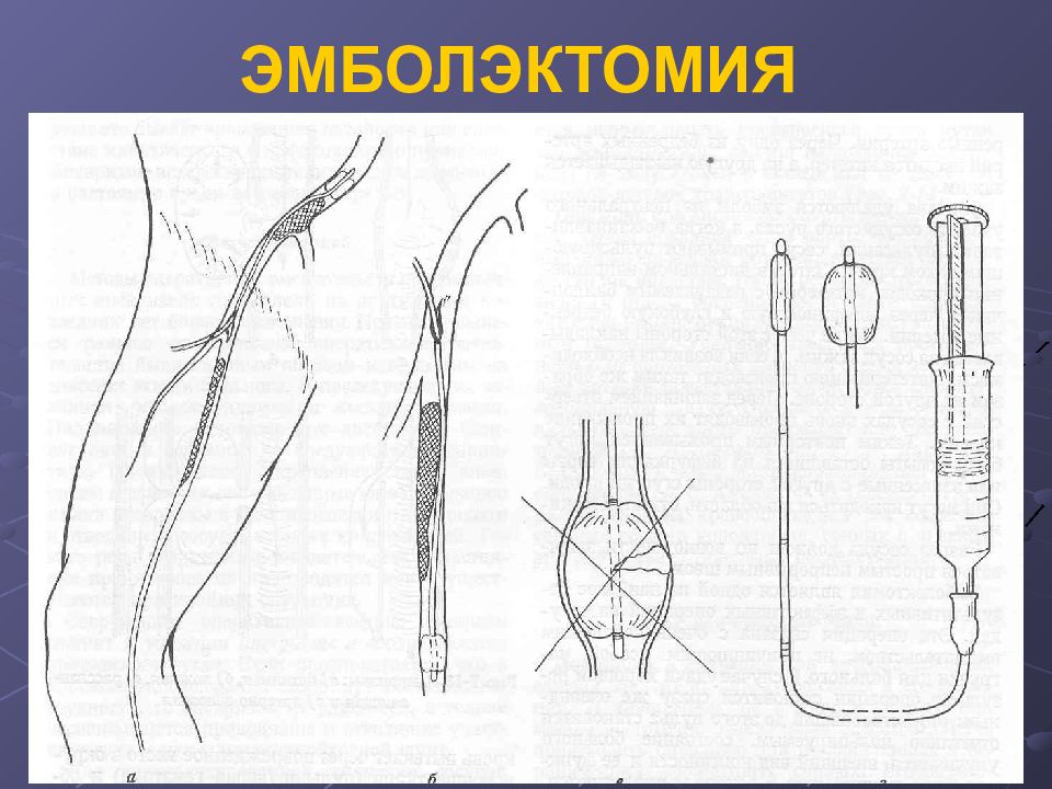 Узи хирургия презентация