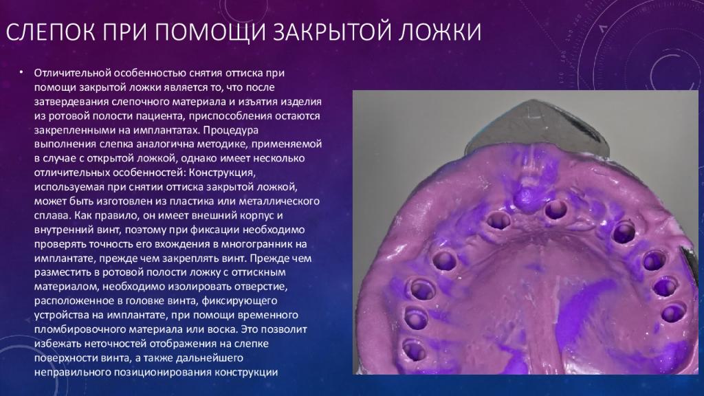 Слепок для импланта. Методика снятия оттисков. Индивидуальная ложка для имплантатов. Индивидуальная ложка в стоматологии.