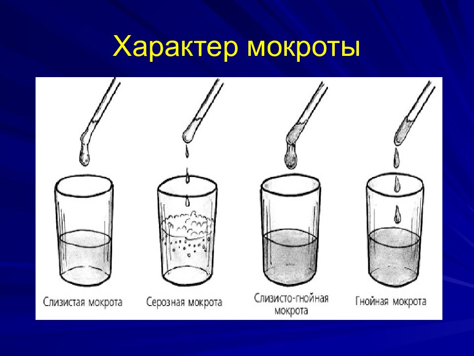 Сбор мокроты картинки