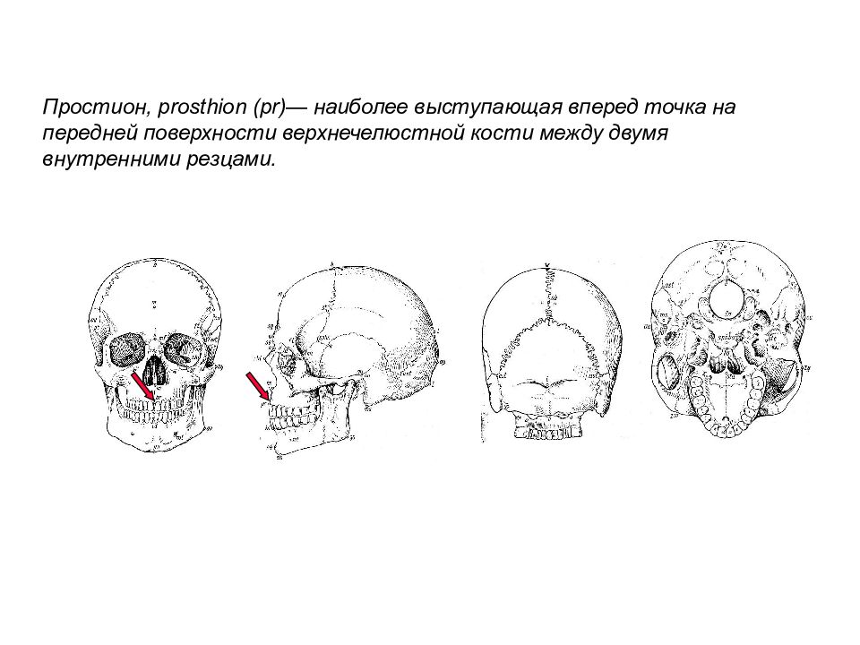 Точки вперед. Опистокранион. Простион точка. Назион и простион. Эурион.