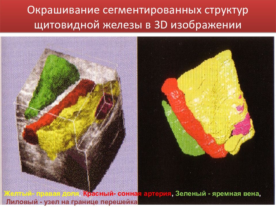 Сегментировать. Сегментированное изображение. Приборы для измерения механических характеристик организма.. Сегментированная. Сегментированный
