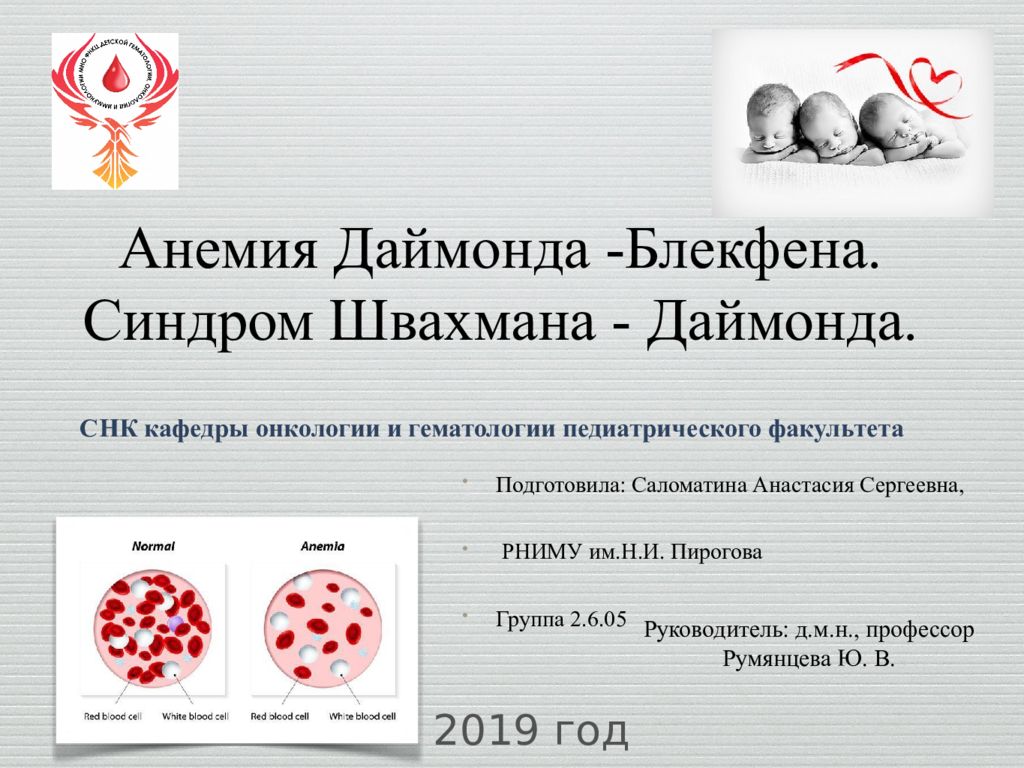 Анемия Даймонда -Блекфена. Синдром Швахмана - Даймонда.