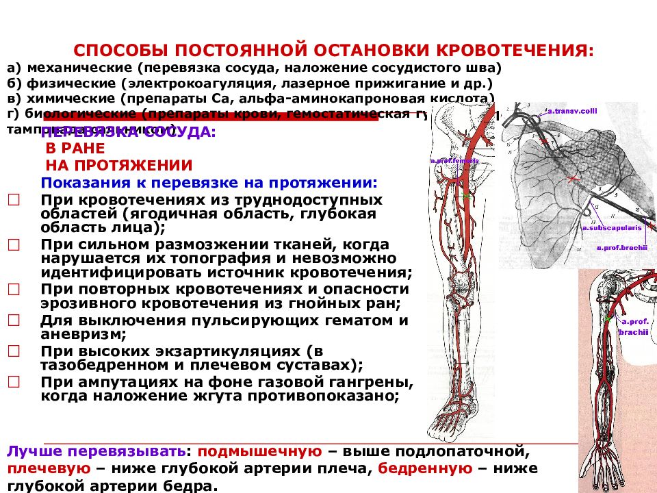 Перевязка в ране и на протяжении. Перевязка сосуда на протяжении. Перевязка магистральных сосудов. Перевязка артерии на протяжении. Перевязка кровеносного сосуда на протяжении.