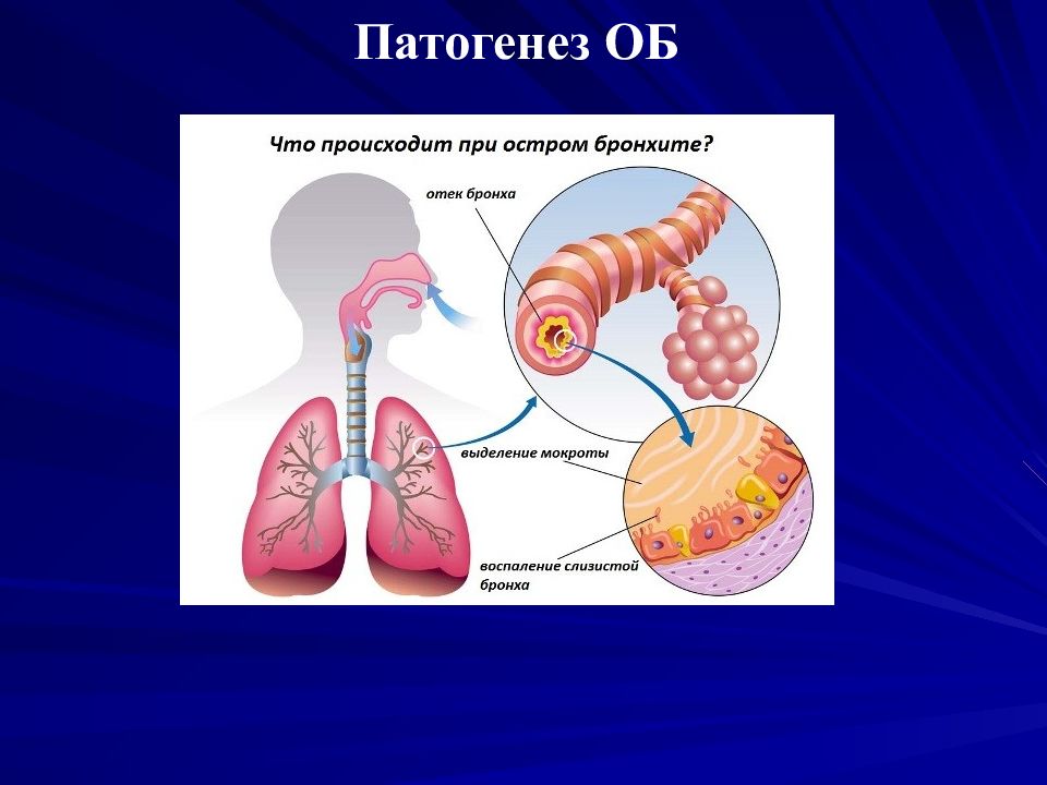 Бронхит педиатрия презентация