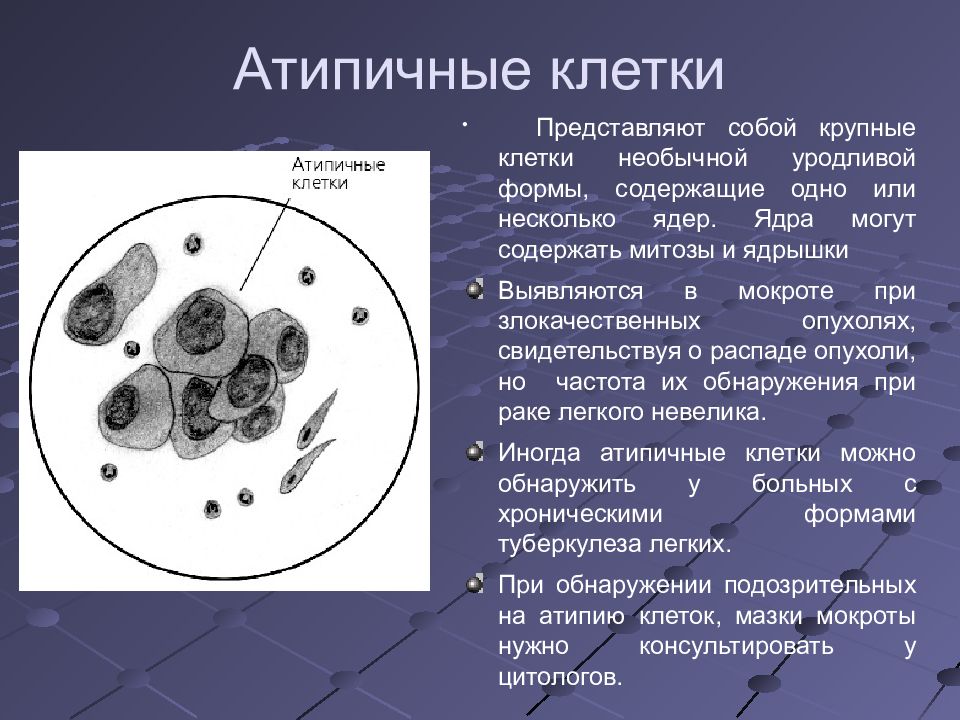 Наличие клеточной. Мокрота атипичные клетки исследование мокроты. Атипичные клетки при микроскопии мокроты. Клетки с признаками атипии в мокроте. Цитологическое исследование на атипические клетки.