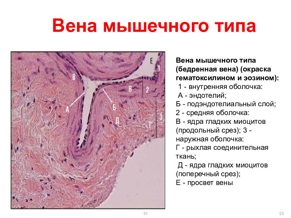 Мышцы вен. Вена мышечного типа гематоксилин эозин. Вена безмышечного типа гистология. Вена мышечного типа окраска гематоксилином и эозином. Бедренная Вена гистология.