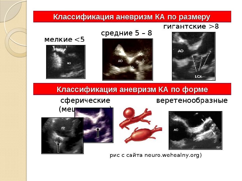 Мультисистемный воспалительный синдром у детей презентация