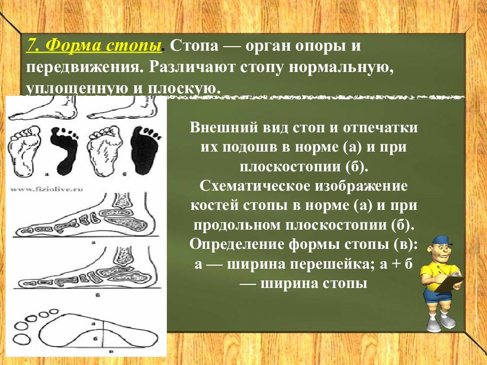 Оценка формы стопы. Отпечаток стопы с продольным плоскостопием. Оценка формы стопы. Продольное плоскостопие и поперечное плоскостопие. Оценка формы стопы.