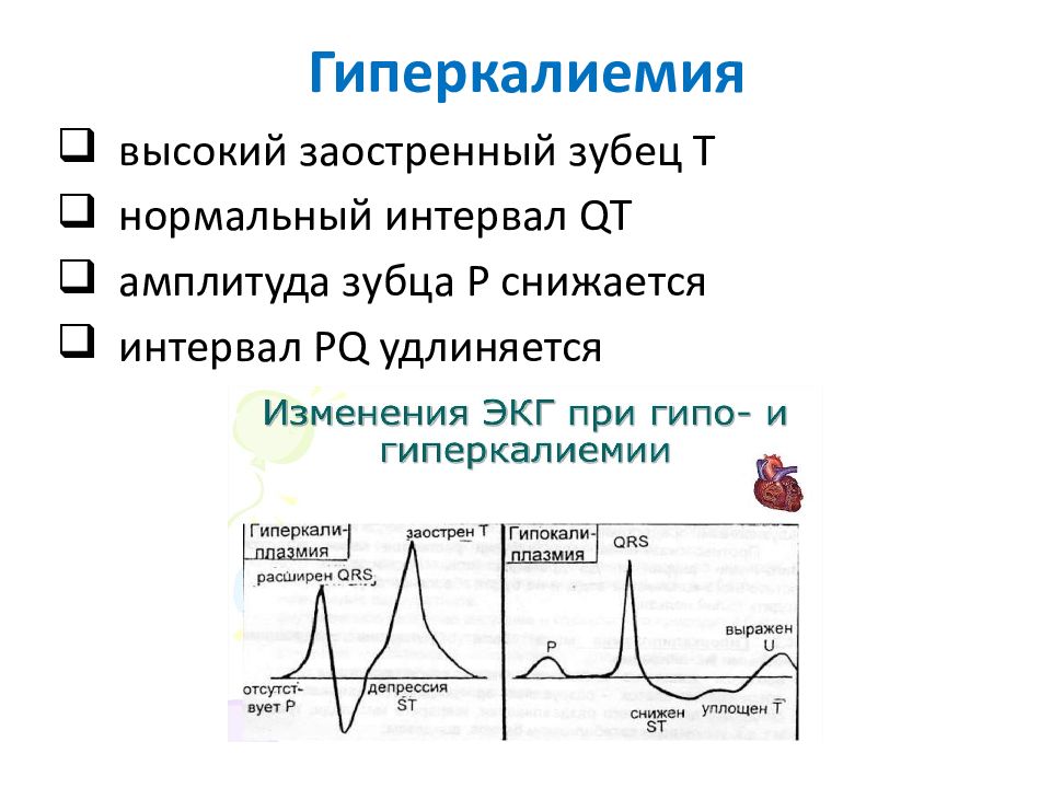 Гиперкалиемия экг картина