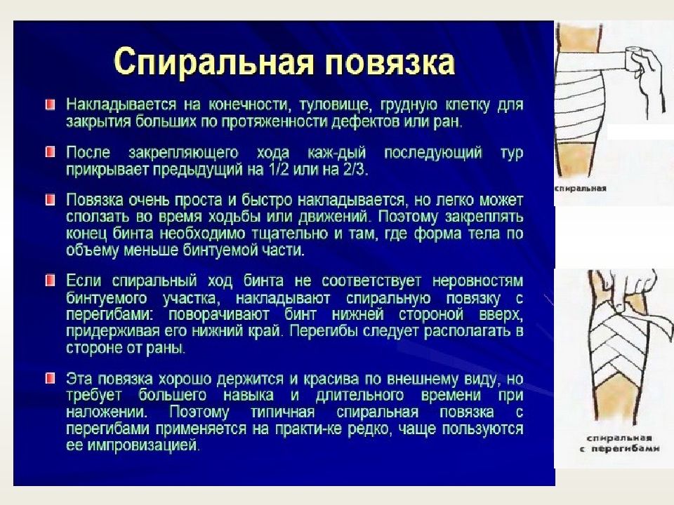 Способы наложения перевязок. Порядок наложения повязки. Спиральная повязка на конечность. Бинтовые повязки. Правило наложение повязок.