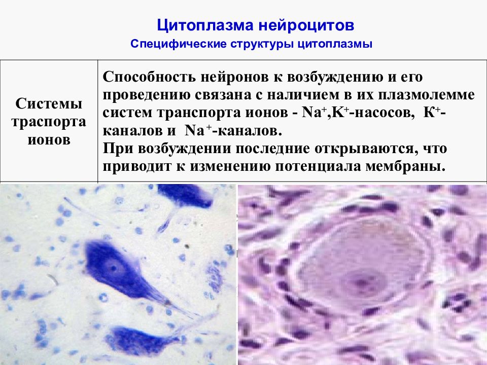 Специфическая структура. Нейроциты классификация гистология. Цитоплазма нейрона. Строение нейроцита. Характерные структуры нейроцита.