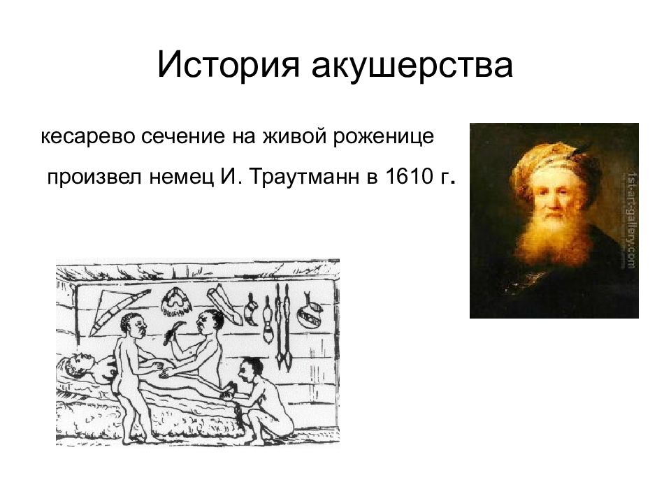 История акушерства презентация