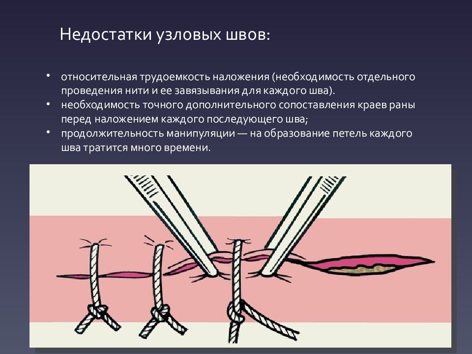 Снятие швов картинки