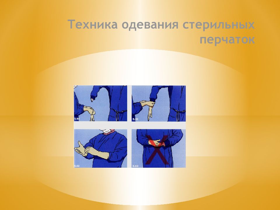 Алгоритм стерильных перчаток. Техника одевания перчаток. Технология одевания стерильных перчаток. Одевание стерильных перчаток алгоритм на себя. Техника одевания хирургических перчаток.