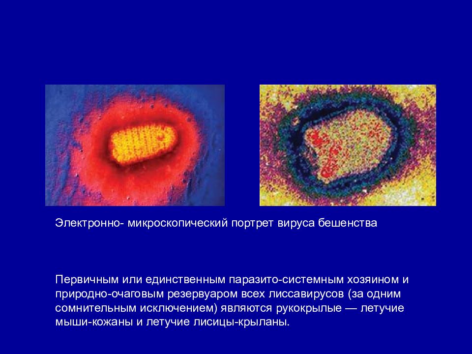 Вирус бешенства клиническая картина