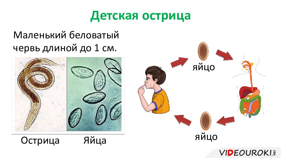 Детская острица
