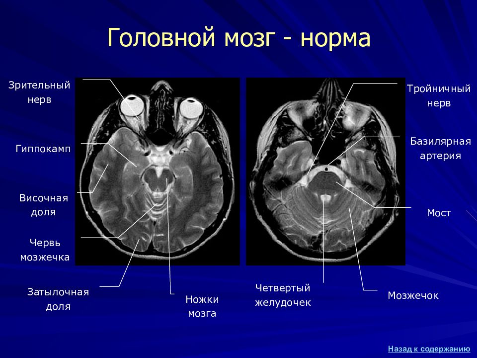 Изображение при кт получают в проекциях