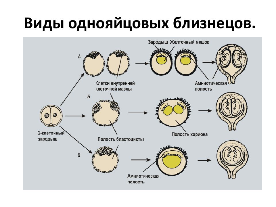 Близнецы и близнецовый метод исследования в генетике человека презентация