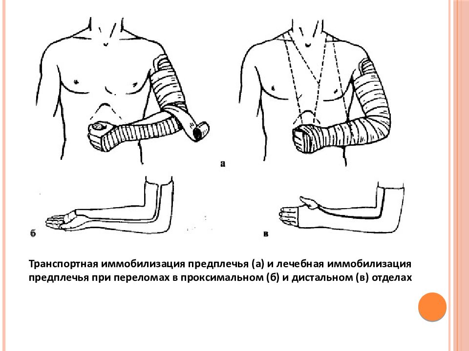 Травмы плеча презентация