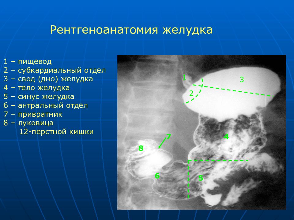 Трети желудка. Отделы желудка анатомия рентген. Рентгенограмма желудка анатомия. Рельеф слизистой оболочки желудка рентген. Рентгеноанатомия желудка.