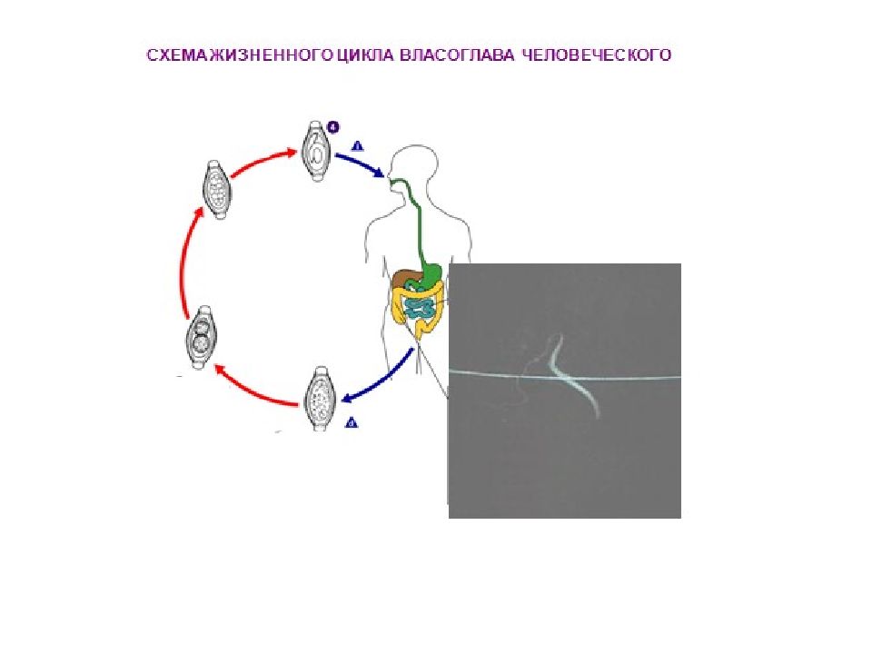 Власоглав трихинелла. Цикл развития острицы схема. Жизненный цикл острицы схема. Жизненный цикл трихинеллы схема. Жизненный цикл острицы человеческой.